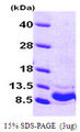 VEGF 121 Protein