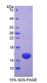 VEGF 121 Protein - Recombinant Vascular Endothelial Growth Factor 121 (VEGF121) by SDS-PAGE