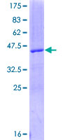 VEGFA / VEGF Protein - 12.5% SDS-PAGE of human VEGFA stained with Coomassie Blue