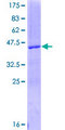 VEGFA / VEGF Protein - 12.5% SDS-PAGE of human VEGFA stained with Coomassie Blue