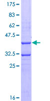 VEGFA / VEGF Protein - 12.5% SDS-PAGE Stained with Coomassie Blue.