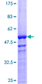 VEGFB Protein - 12.5% SDS-PAGE of human VEGFB stained with Coomassie Blue