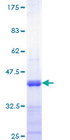 VEGFB Protein - 12.5% SDS-PAGE Stained with Coomassie Blue.