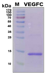 VEGFC Protein - SDS-PAGE under reducing conditions and visualized by Coomassie blue staining