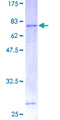 VEGFC Protein - 12.5% SDS-PAGE of human VEGFC stained with Coomassie Blue