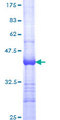 VEGFC Protein - 12.5% SDS-PAGE Stained with Coomassie Blue.