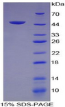VEGFC Protein - Recombinant Vascular Endothelial Growth Factor C By SDS-PAGE
