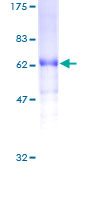 VEGFD Protein - 12.5% SDS-PAGE of human FIGF stained with Coomassie Blue