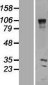 VENTX Protein - Western validation with an anti-DDK antibody * L: Control HEK293 lysate R: Over-expression lysate