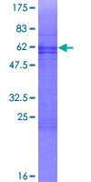 VENTX Protein - 12.5% SDS-PAGE of human VENTX stained with Coomassie Blue