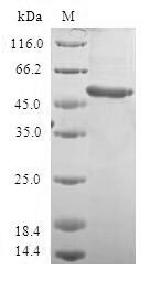 VENTX Protein - (Tris-Glycine gel) Discontinuous SDS-PAGE (reduced) with 5% enrichment gel and 15% separation gel.