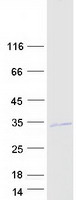 VENTX Protein - Purified recombinant protein VENTX was analyzed by SDS-PAGE gel and Coomassie Blue Staining