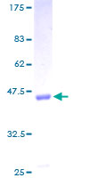 VG5Q / AGGF1 Protein - 12.5% SDS-PAGE of human AGGF1 stained with Coomassie Blue