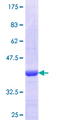 VGLL1 Protein - 12.5% SDS-PAGE Stained with Coomassie Blue.