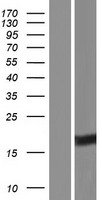 VGLL2 Protein - Western validation with an anti-DDK antibody * L: Control HEK293 lysate R: Over-expression lysate