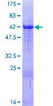 VGLL2 Protein - 12.5% SDS-PAGE of human VGLL2 stained with Coomassie Blue