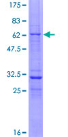 VGLL3 Protein - 12.5% SDS-PAGE of human VGLL3 stained with Coomassie Blue