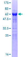 VGLL4 Protein - 12.5% SDS-PAGE of human VGLL4 stained with Coomassie Blue