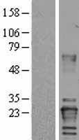 VHL / Von Hippel Lindau Protein - Western validation with an anti-DDK antibody * L: Control HEK293 lysate R: Over-expression lysate