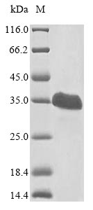 VHL / Von Hippel Lindau Protein - (Tris-Glycine gel) Discontinuous SDS-PAGE (reduced) with 5% enrichment gel and 15% separation gel.