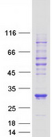 VHL / Von Hippel Lindau Protein - Purified recombinant protein VHL was analyzed by SDS-PAGE gel and Coomassie Blue Staining