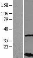 VHLL Protein - Western validation with an anti-DDK antibody * L: Control HEK293 lysate R: Over-expression lysate