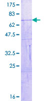 VIL1 / Villin Protein - 12.5% SDS-PAGE of human VIL1 stained with Coomassie Blue