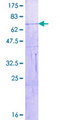 VIL1 / Villin Protein - 12.5% SDS-PAGE of human VIL1 stained with Coomassie Blue