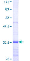 VIL1 / Villin Protein - 12.5% SDS-PAGE Stained with Coomassie Blue.
