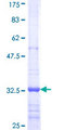 VIL1 / Villin Protein - 12.5% SDS-PAGE Stained with Coomassie Blue.
