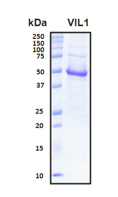 VIL1 / Villin Protein