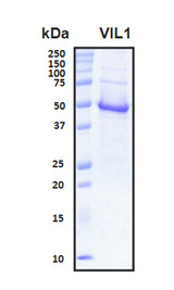 VIL1 / Villin Protein