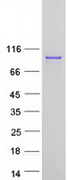 VIL1 / Villin Protein - Purified recombinant protein VIL1 was analyzed by SDS-PAGE gel and Coomassie Blue Staining