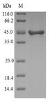 VILIP / VSNL1 Protein - (Tris-Glycine gel) Discontinuous SDS-PAGE (reduced) with 5% enrichment gel and 15% separation gel.