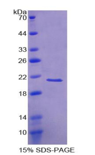 VILIP / VSNL1 Protein - Recombinant Visinin Like Protein 1 By SDS-PAGE