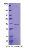VILIP / VSNL1 Protein - Recombinant Visinin Like Protein 1 By SDS-PAGE