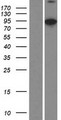 Villin-Like / VILL Protein - Western validation with an anti-DDK antibody * L: Control HEK293 lysate R: Over-expression lysate