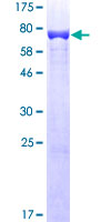 Vimentin Protein - 12.5% SDS-PAGE of human VIM stained with Coomassie Blue
