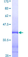 Vimentin Protein - 12.5% SDS-PAGE Stained with Coomassie Blue.