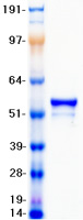 Vimentin Protein - Purified recombinant protein VIM was analyzed by SDS-PAGE gel and Coomassie Blue Staining