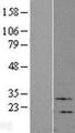 VIP Protein - Western validation with an anti-DDK antibody * L: Control HEK293 lysate R: Over-expression lysate