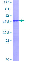 VIP Protein - 12.5% SDS-PAGE of human VIP stained with Coomassie Blue