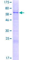 VIPERIN / RSAD2 Protein - 12.5% SDS-PAGE of human RSAD2 stained with Coomassie Blue