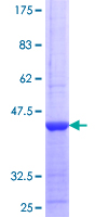 VIPERIN / RSAD2 Protein - 12.5% SDS-PAGE Stained with Coomassie Blue.