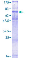 VIPR1 Protein - 12.5% SDS-PAGE of human VIPR1 stained with Coomassie Blue