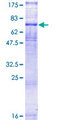 VIPR1 Protein - 12.5% SDS-PAGE of human VIPR1 stained with Coomassie Blue