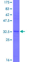 VIPR1 Protein - 12.5% SDS-PAGE Stained with Coomassie Blue.