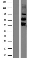 VIT Protein - Western validation with an anti-DDK antibody * L: Control HEK293 lysate R: Over-expression lysate