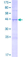 VIT Protein - 12.5% SDS-PAGE of human VIT stained with Coomassie Blue