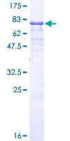 Vitamin D Receptor / VDR Protein - 12.5% SDS-PAGE of human VDR stained with Coomassie Blue